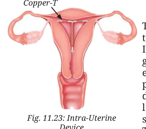 Fig 11.23